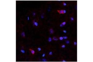 Netrin 4 antibody used at a concentration of 10 ug/ml to detect neurons and epithelial cells in rodent brain (red). (Netrin 4 anticorps  (N-Term))