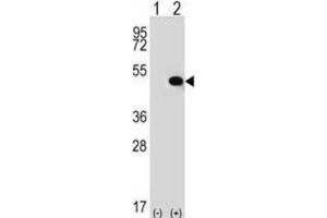 Western Blotting (WB) image for anti-Thyroid Hormone Receptor Interactor 13 (TRIP13) antibody (ABIN2996863) (TRIP13 anticorps)