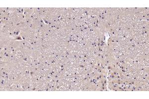 Detection of BDNF in Mouse Spinal cord Tissue using Polyclonal Antibody to Brain Derived Neurotrophic Factor (BDNF) (BDNF anticorps  (AA 20-252))