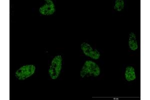 Immunofluorescence of monoclonal antibody to PLCB2 on HeLa cell. (Phospholipase C beta 2 anticorps  (AA 1-199))