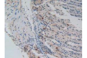 IHC-P analysis of Mouse Stomach Tissue, with DAB staining. (NUP85 anticorps  (AA 418-653))