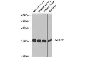 Western blot analysis of extracts of various cell lines using MSRB2 Polyclonal Antibody at dilution of 1:1000. (MSRB2 anticorps)