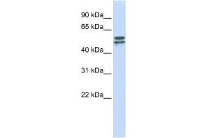 G6PD antibody used at 1 ug/ml to detect target protein. (Glucose-6-Phosphate Dehydrogenase anticorps  (Middle Region))