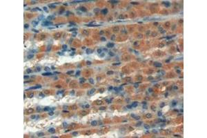 Figure. (GREM1 anticorps  (AA 26-184))