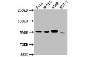 Western Blot Positive WB detected in: Hela whole cell lysate, HUVEC whole cell lysate, A549 whole cell lysate, MCF-7 whole cell lysate All lanes: CD44 antibody at 1:1500 Secondary Goat polyclonal to Mouse IgG at 1/10000 dilution Predicted band size: 82, 4, 78, 77, 81, 79, 75, 54,47, 40, 44, 33, 74, 76, 38, 16 kDa Observed band size: 95 kDa (CD44 anticorps  (AA 21-220))