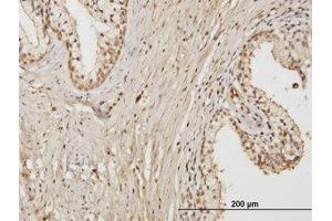 Image no. 1 for anti-RAB17, Member RAS Oncogene Family (RAB17) (AA 1-213) antibody (ABIN599295) (RAB17 anticorps  (AA 1-213))
