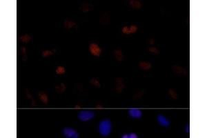 Immunofluorescence analysis of U-2 OS cells using PSME3 Polyclonal Antibody at dilution of 1:100 (40x lens). (PSME3 anticorps)