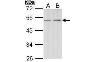 WB Image Sample (30 ug of whole cell lysate) A: A431 , B: H1299 10% SDS PAGE antibody diluted at 1:1000