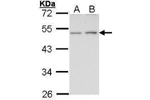 WB Image Sample (30 ug of whole cell lysate) A: A431 , B: H1299 10% SDS PAGE antibody diluted at 1:1000 (EDNRB anticorps  (N-Term))