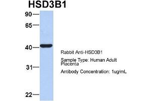 Host: Rabbit Target Name: HSD3B1 Sample Type: Human Adult Placenta Antibody Dilution: 1. (HSD3B1 anticorps  (N-Term))