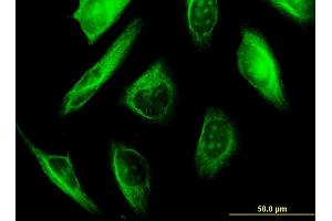 Immunofluorescence of monoclonal antibody to TUBA1A on HeLa cell.