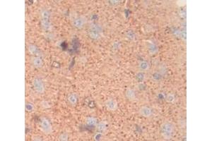 IHC-P analysis of Rat Tissue, with DAB staining. (DSTYK anticorps  (AA 650-904))