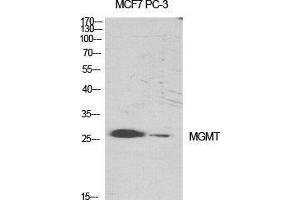 Western Blot (WB) analysis of specific cells using MGMT Polyclonal Antibody. (MGMT anticorps  (N-Term))