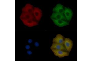 PIKFYVE Mouse Monoclonal Antibody staining Hela cells by IF/ICC. (PIKFYVE anticorps)