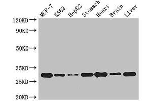 Western Blot Positive WB detected in: MCF-7 whole cell lysate, K562 whole cell lysate, HepG2 whole cell lysate, Mouse stomach tissue, Mouse heart tissue, Mouse brain tissue, Mouse liver tissue All lanes: RABGAP1L antibody at 3 μg/mL Secondary Goat polyclonal to rabbit IgG at 1/50000 dilution Predicted band size: 30, 93, 69, 95, 91, 44, 42, 43, 9 kDa Observed band size: 30 kDa