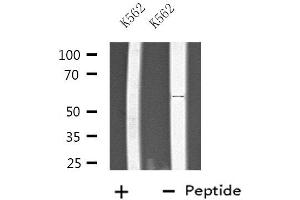 Western blot analysis of extracts from K562 cells, using PTGIS antibody. (PTGIS anticorps  (Internal Region))