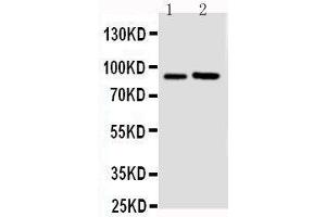 Anti-FGFR3 antibody, Western blotting Lane 1: U87 Cell Lysate Lane 2: SGC Cell Lysate (FGFR3 anticorps  (N-Term))