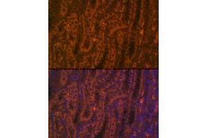 Immunofluorescence analysis of mouse testis using  Rabbit pAb (ABIN6131167, ABIN6136429, ABIN6136430 and ABIN6216480) at dilution of 1:100 (40x lens).