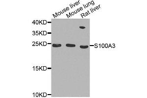 Western blot analysis of extracts of various cell lines, using S100A3 antibody. (S100A3 anticorps  (AA 1-101))