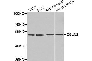 Western Blotting (WB) image for anti-Egl-9 Family Hypoxia Inducible Factor 2 (EGLN2) antibody (ABIN1872459) (PHD1 anticorps)