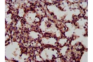 IHC image of ABIN7158226 diluted at 1:600 and staining in paraffin-embedded human lung tissue performed on a Leica BondTM system.