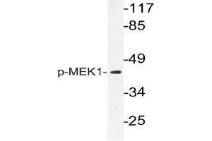 Western blot (WB) analysis of p-MEK1 antibody in extracts from K562 cells. (MEK1 anticorps  (pThr292))