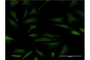 Immunofluorescence of monoclonal antibody to NPM2 on HeLa cell. (NPM2 anticorps  (AA 1-214))