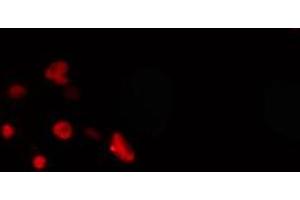 ABIN6274269 staining COLO205 cells by IF/ICC. (MEOX2 anticorps  (Internal Region))