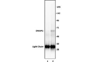 DMAP1 antibody (pAb) tested by Immunoprecipitation. (DMAP1 anticorps  (C-Term))