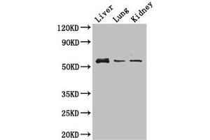 Western Blot Positive WB detected in: Mouse liver tissue, Mouse lung tissue, Mouse kidney tissue All lanes: MMP8 antibody at 3 μg/mL Secondary Goat polyclonal to rabbit IgG at 1/50000 dilution Predicted band size: 54 kDa Observed band size: 54 kDa (MMP8 anticorps  (AA 22-283))