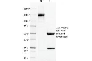 SDS-PAGE Analysis Purified Thrombomodulin Monoclonal/CD141 Antibody (THBD/1591).