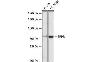 Western blot analysis of extracts of various cell lines, using SRPR antibody (ABIN6130704, ABIN6148457, ABIN6148458 and ABIN6221633) at 1:1000 dilution. (SRPR anticorps  (AA 1-220))
