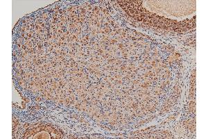 ABIN6267554 at 1/100 staining rat ovarian tissue sections by IHC-P.