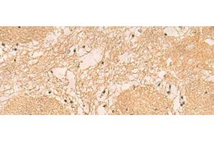 Immunohistochemistry of paraffin-embedded Human brain tissue using EMC1 Polyclonal Antibody at dilution of 1:40(x200)
