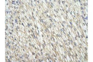 Rabbit Anti-CNOT7 antibody         Paraffin Embedded Tissue:  Human Heart    cell Cellular Data:  cardiac cell    Antibody Concentration:  4.