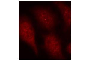 Immunofluorescence staining of methanol-fixed HeLa cells using Phospho-CDK6-Y24 antibody (ABIN2987839). (CDK6 anticorps  (pTyr24))
