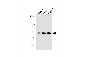 All lanes : Anti-ATG7 Antibody (C-term) at 1:500 dilution Lane 1: Caki-1 whole cell lysate Lane 2: Hela whole cell lysate Lane 3: HepG2 whole cell lysate Lysates/proteins at 40 μg per lane.