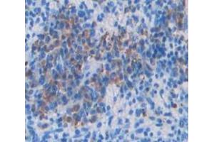 IHC-P analysis of Kidney tissue, with DAB staining. (VAV1 anticorps  (AA 565-795))