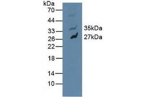 Figure. (MAPK10 anticorps  (AA 88-332))