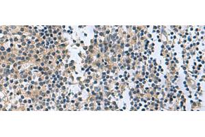 Immunohistochemistry of paraffin-embedded Human tonsil tissue using RGS2 Polyclonal Antibody at dilution of 1:95(x200)