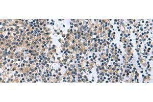Immunohistochemistry of paraffin-embedded Human tonsil tissue using RGS2 Polyclonal Antibody at dilution of 1:95(x200) (RGS2 anticorps)