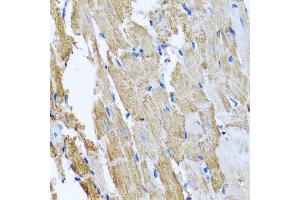 Immunohistochemistry of paraffin-embedded rat heart using CCM2 antibody at dilution of 1:100 (x40 lens).