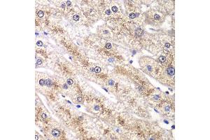 Immunohistochemistry of paraffin-embedded human liver injury using RALB antibody at dilution of 1:100 (x40 lens). (RALB anticorps)
