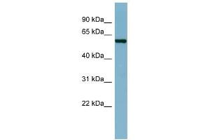CAP1 antibody used at 1 ug/ml to detect target protein. (CAP1 anticorps)