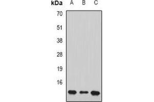 Western blot analysis of PC4 expression in HL60 (A), Jurkat (B), mouse brain (C) whole cell lysates. (SUB1 anticorps)