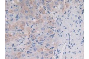 DAB staining on IHC-P; Samples: Mouse Ovary Tissue