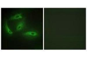 Immunofluorescence analysis of HeLa cells, using CDKL4 antibody. (CDKL4 anticorps  (C-Term))