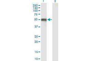 Western Blot analysis of OXCT1 expression in transfected 293T cell line by OXCT1 MaxPab polyclonal antibody.