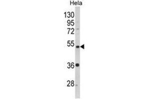 Western blot analysis of PPP2R2B Antibody (Center) in Hela cell line lysates (35ug/lane). (PPP2R2B anticorps  (AA 110-139))