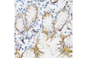 Immunohistochemistry of paraffin-embedded human stomach using CDH1 antibody (ABIN5997408) at dilution of 1/200 (40x lens). (E-cadherin anticorps)